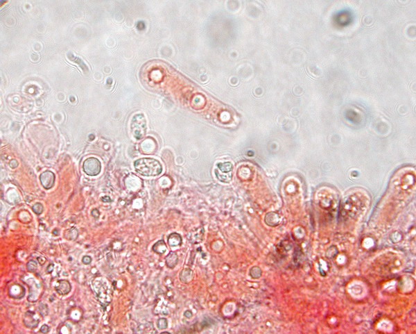 Callistosporium  xanthophyllum